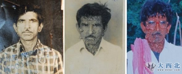 前后变化：左侧是乌马尔在1987年37岁时拍的照片；中间是1998年他48岁时拍的照片；右侧是2006年56岁时拍的照片