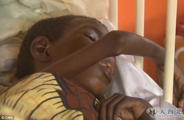 仅在乌干达北部，患上瞌睡病的儿童人数就达到3000。在苏丹和坦桑尼亚也出现大量瞌睡病病例